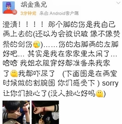 這樣的美術生傷不起！手繪逼真?zhèn)趪槈男』锇?jpg